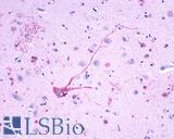Leukotriene B4 Receptor / BLT1 Antibody - Brain, Amygdala, neurons and glia