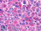 LGR6 Antibody - Skin, melanoma