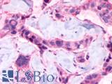 LPAR6 / P2RY5 / P2Y5 Antibody - Breast, adenocarcinoma