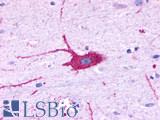 LPAR6 / P2RY5 / P2Y5 Antibody - Brain, cortex, neuron