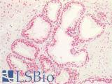 MAX Antibody - Human Prostate: Formalin-Fixed, Paraffin-Embedded (FFPE)