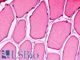 MB / Myoglobin Antibody - Anti-MB / Myoglobin antibody IHC staining of human skeletal muscle. Immunohistochemistry of formalin-fixed, paraffin-embedded tissue after heat-induced antigen retrieval.