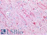 MBP / Myelin Basic Protein Antibody - Human Brain, Cortex: Formalin-Fixed, Paraffin-Embedded (FFPE)