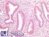 MEN1 / Menin Antibody - Human Uterus: Formalin-Fixed, Paraffin-Embedded (FFPE)