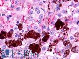 MLNR/GPR38/Motilin Receptor Antibody - Skin, Malignant Melanoma