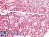 MLPH / Melanophilin Antibody - Human Small Intestine: Formalin-Fixed, Paraffin-Embedded (FFPE)