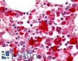 MST1R / RON Antibody - Bone marrow, macrophages