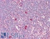 MYC / c-Myc Antibody - Anti-MYC / c-Myc antibody IHC of human thymus. Immunohistochemistry of formalin-fixed, paraffin-embedded tissue after heat-induced antigen retrieval. Antibody dilution 1:100.