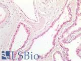 MYC / c-Myc Antibody - Human Prostate: Formalin-Fixed, Paraffin-Embedded (FFPE)