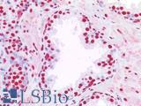 NALP3 / NLRP3 Antibody - Human Prostate: Formalin-Fixed, Paraffin-Embedded (FFPE)
