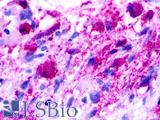 NMUR1 Antibody - Brain, Glioblastoma