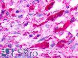 NMUR1 Antibody - Brain, Glioblastoma
