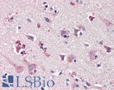 NOS1 / nNOS Antibody - Anti-nNOS / NOS1 antibody IHC of human brain, cortex. Immunohistochemistry of formalin-fixed, paraffin-embedded tissue after heat-induced antigen retrieval. Antibody concentration 20 ug/ml.