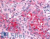 NPBWR2 / GPR8 Antibody - Lung, non small cell carcinoma