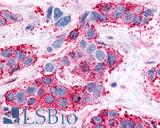 NPFFR1 / GPR147 Antibody - Breast, Carcinoma