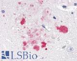NR1D1 Antibody - Brain, Alzheimer's, senile plaque
