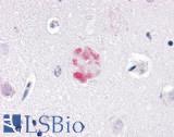 NR1D1 Antibody - Brain, Alzheimer's, senile plaque