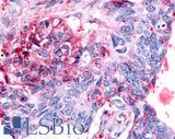 NR6A1 / GCNF Antibody - Colon, carcinoma