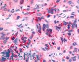 NTSR2 / NTR2 Antibody - Brain, glioblastoma