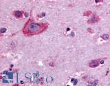 OPRD1 / Delta Opioid Receptor Antibody - Anti-Delta Opioid Receptor antibody IHC of human brain, neurons and glia. Immunohistochemistry of formalin-fixed, paraffin-embedded tissue after heat-induced antigen retrieval.
