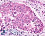 OR2A4 Antibody - Breast, Carcinoma