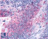 OR2A4 Antibody - Colon, Carcinoma