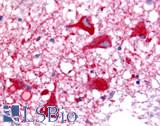 OR6N1 Antibody - Brain, Medulla