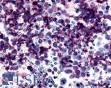 P2RY12 / P2Y12 Antibody - Lung, Small Cell Carcinoma
