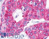 P2RY14 / GPR105 Antibody - Breast, adenocarcinoma