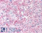 PLA2G3 Antibody - Brain, Glioblastoma