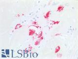 Placental Lactogen Antibody - Human, Pregnant Uterus: Formalin-Fixed, Paraffin-Embedded (FFPE)