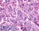 PROKR2/Prokineticin Receptor 2 Antibody - Breast, Carcinoma