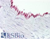 PTGS1 / COX-1 Antibody - Anti-PTGS1 / COX-1 antibody IHC of human vessel. Immunohistochemistry of formalin-fixed, paraffin-embedded tissue after heat-induced antigen retrieval. Antibody dilution 1:100.