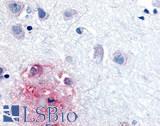 RORB / ROR Beta Antibody - Brain, Alzheimer's disease, senile plaque