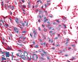 RXFP2 / LGR8 Antibody - Skin, Malignant Melanoma