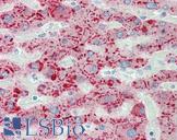 SAA1 / SAA / Serum Amyloid A Antibody - Anti-SAA1 / SAA / Serum Amyloid A antibody IHC staining of human liver. Immunohistochemistry of formalin-fixed, paraffin-embedded tissue after heat-induced antigen retrieval. Antibody dilution 1:50.