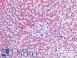 SCD1 / SCD Antibody - Human Liver: Formalin-Fixed, Paraffin-Embedded (FFPE)