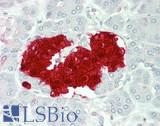 SCGN / Secretagogin Antibody - Human Pancreas, islets of Langerhans: Formalin-Fixed, Paraffin-Embedded (FFPE)