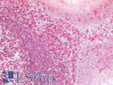 SDC1 / Syndecan 1 / CD138 Antibody - Human Tonsil: Formalin-Fixed, Paraffin-Embedded (FFPE)