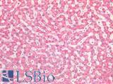 SDHB Antibody - Human Liver: Formalin-Fixed, Paraffin-Embedded (FFPE)