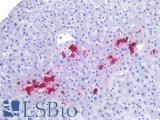 Sialylated Lewis a / CA 19-9 Antibody - Human Liver: Formalin-Fixed, Paraffin-Embedded (FFPE)