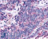 SIPR3 / EDG3 / S1P3 Antibody - Prostate, Carcinoma
