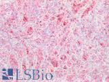 SLC2A1 / GLUT-1 Antibody - Human Spleen: Formalin-Fixed, Paraffin-Embedded (FFPE)