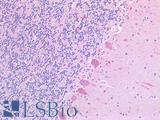 SLC6A8 Antibody - Human Brain, Cerebellum: Formalin-Fixed, Paraffin-Embedded (FFPE)