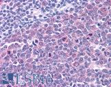 SMARCA4 / BRG1 Antibody - Anti-SMARCA4 / BRG1 antibody IHC of human tonsil. Immunohistochemistry of formalin-fixed, paraffin-embedded tissue after heat-induced antigen retrieval. Antibody concentration 10 ug/ml.