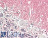 SNCA / Alpha-Synuclein Antibody - Human Brain, Cerebellum: Formalin-Fixed, Paraffin-Embedded (FFPE)