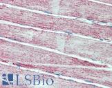 SOD2 / Mn SOD Antibody - Anti-MNSOD / SOD2 antibody IHC staining of human skeletal muscle. Immunohistochemistry of formalin-fixed, paraffin-embedded tissue after heat-induced antigen retrieval.