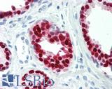 SOX9 Antibody - Human Prostate: Formalin-Fixed, Paraffin-Embedded (FFPE)