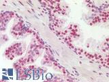 SSB / La Antibody - Human Prostate: Formalin-Fixed, Paraffin-Embedded (FFPE)