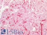 ST6GAL1 / CD75 Antibody - Human Pancreas: Formalin-Fixed, Paraffin-Embedded (FFPE)